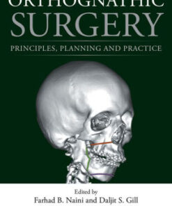 Orthognathic Surgery - Principles