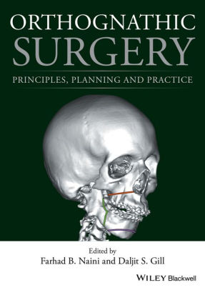 Orthognathic Surgery - Principles