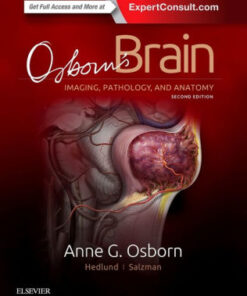 Osborn's Brain Imaging