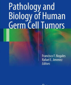 Pathology and Biology of Human Germ Cell Tumors by Nogales