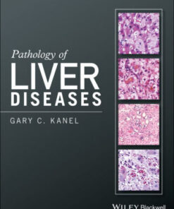 Pathology of Liver Diseases by Gary C. Kanel