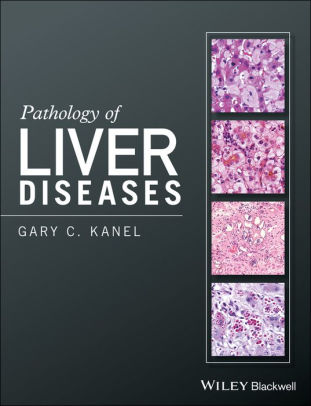 Pathology of Liver Diseases by Gary C. Kanel