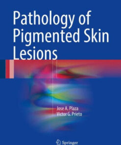 Pathology of Pigmented Skin Lesions by Jose A. Plaza