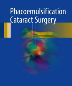 Phacoemulsification Cataract Surgery by Rajen Gupta