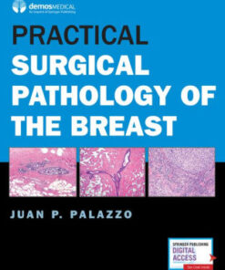 Practical Surgical Pathology of the Breast by Juan P. Palazzo