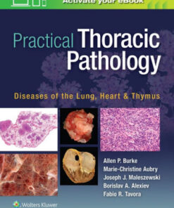 Practical Thoracic Pathology by Allen P. Burke