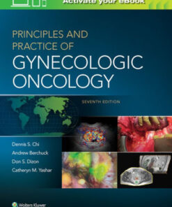 Principles and Practice of Gynecologic Oncology 7th Ed by Dennis Chi