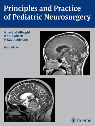 Principles and Practice of Pediatric Neurosurgery 3rd Edition By A. Leland Albright