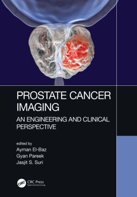 Prostate Cancer Imaging by Ayman ElBaz