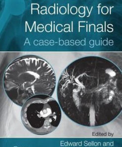 Radiology for Medical Finals - A case based guide by Sellon