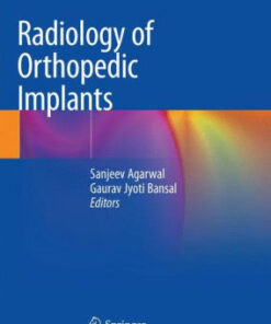 Radiology of Orthopedic Implants by Sanjeev Agarwal