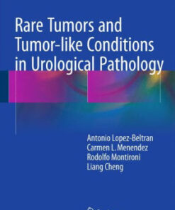 Rare Tumors and Tumor-like Conditions in Urological Pathology by Beltran