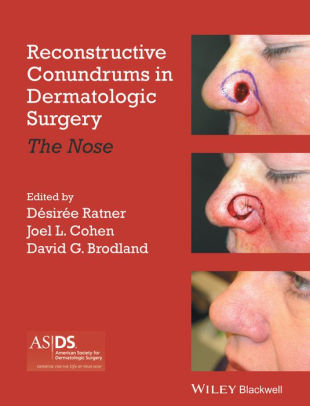 Reconstructive Conundrums in Dermatologic Surgery by Ratner