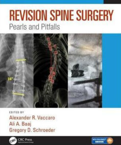 Revision Spine Surgery - Pearls and Pitfalls by Schroeder