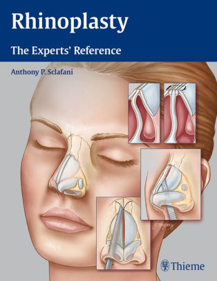 Rhinoplasty - The Experts' Reference by Sclafani