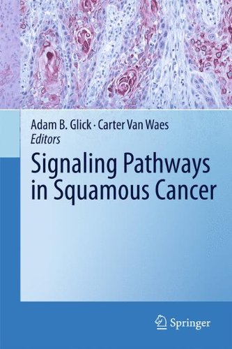 Signaling Pathways in Squamous Cancer By Adam B. Glick