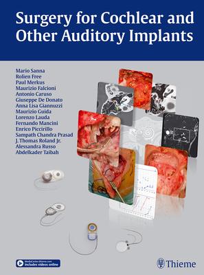 Surgery for Cochlear and Other Auditory Implants by Mario Sanna