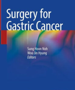 Surgery for Gastric Cancer by Sung Hoon Noh