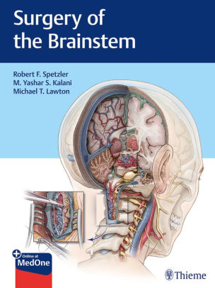Surgery of the Brainstem by Robert F. Spetzler