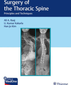 Surgery of the Thoracic Spine by Ali Baaj