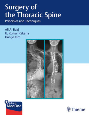 Surgery of the Thoracic Spine by Ali Baaj