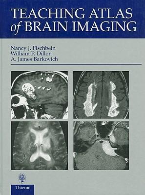 Teaching Atlas of Brain Imaging 2nd Edition by William P. Dillon