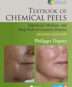 Textbook of Chemical Peels - Superficial