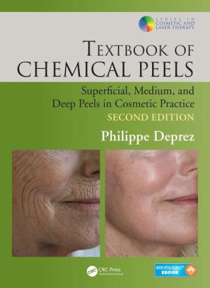 Textbook of Chemical Peels - Superficial