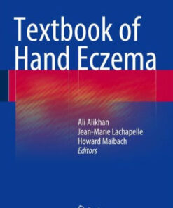 Textbook of Hand Eczema by Ali Alikhan