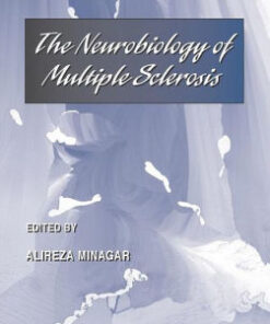 The Neurobiology of Multiple Sclerosis by Alireza Minagar