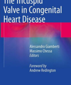 The Tricuspid Valve in Congenital Heart Disease By Alessandro Giamberti