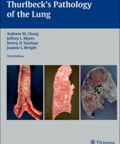 Thurlbeck's Pathology of the Lung 3rd Edition by Andrew M. Churg