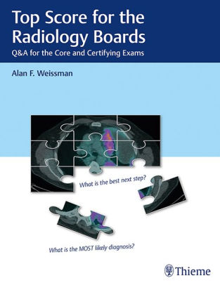 Top Score for the Radiology Boards by Alan Weissman