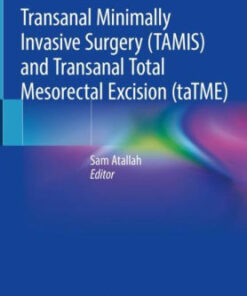 Transanal Minimally Invasive Surgery (TAMIS) by Sam Atallah