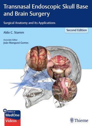 Transnasal Endoscopic Skull Base and Brain Surgery 2nd Edition by Stamm