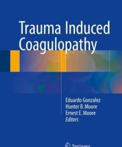 Trauma Induced Coagulopathy by Eduardo Gonzalez