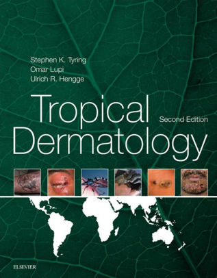 Tropical Dermatology 2nd Edition by Steven K. Tyring