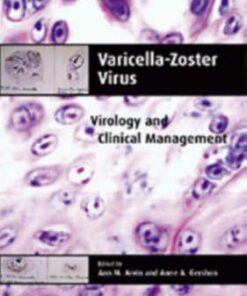 Varicella Zoster Virus - Virology and Clinical Management by Ann M. Arvin