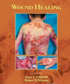 Wound Healing by Anna Falabella