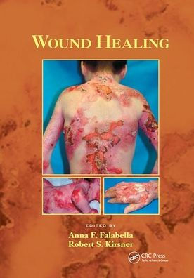 Wound Healing by Anna Falabella