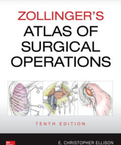 Zollinger's Atlas of Surgical Operations 10th Edition by Elliso