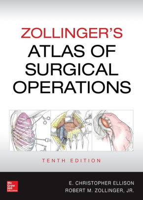 Zollinger's Atlas of Surgical Operations 10th Edition by Elliso