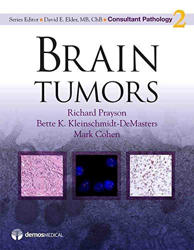Brain Tumors by Richard Prayson