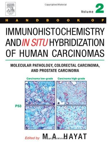 Handbook of Immunohistochemistry and in Situ Hybridization of Human Carcinomas - Vol 2 Molecular Pathology
